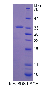 透明带糖蛋白2(ZP2)重组蛋白,Recombinant Zona Pellucida Glycoprotein 2, Sperm Receptor (ZP2)