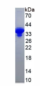 铜蓝蛋白(CP)重组蛋白,Recombinant Ceruloplasmin (CP)