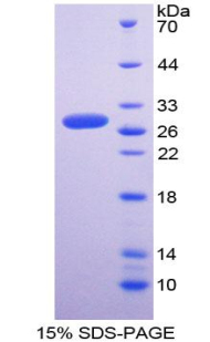 铜伴侣超氧化物歧化酶(SOD4)重组蛋白,Recombinant Superoxide Dismutase, Copper Chaperone (SOD4)