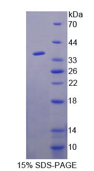 同源域相互作用蛋白激酶1(HIPK1)重组蛋白,Recombinant Homeodomain Interacting Protein Kinase 1 (HIPK1)