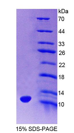 同源域特有蛋白(HOP)重組蛋白,Recombinant Homeodomain Only Protein (HOP)