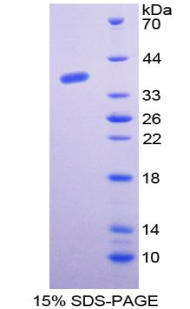 通用转录因子ⅡE肽1(GTF2E1)重组蛋白,Recombinant General Transcription Factor IIE, Polypeptide 1 (GTF2E1)