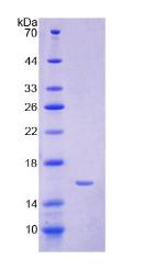 铁调素(Hepc)重组蛋白,Recombinant Hepcidin (Hepc)