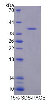 甜菜碱高半胱氨酸甲基转移酶(BHMT)重组蛋白,Recombinant Betaine Homocysteine Methyltransferase (BHMT)