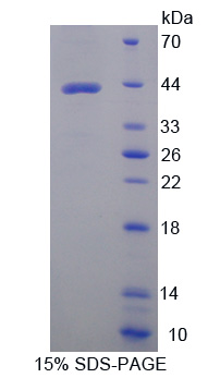 天冬氨酸转氨酶2(AST2)重组蛋白,Recombinant Aspartate Aminotransferase 2 (AST2)