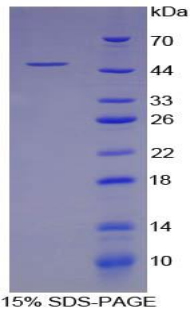 天冬氨酸轉(zhuǎn)氨酶(AST)重組蛋白,Recombinant Aspartate Aminotransferase (AST)