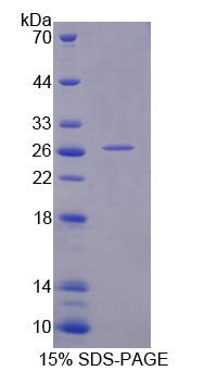 天冬氨酸β羟化酶(ASPH)重组蛋白,Recombinant Aspartate Beta Hydroxylase (ASPH)