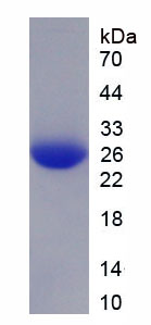 糖原磷酸化酶M(PYGM)重组蛋白,Recombinant Glycogen Phosphorylase, Muscle (PYGM)