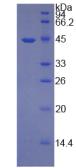 糖抗原19-9(CA19-9)重組蛋白,Recombinant Carbohydrate Antigen 19-9 (CA19-9)