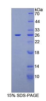 糖抗原125(CA125)重組蛋白,Recombinant Carbohydrate Antigen 125 (CA125)