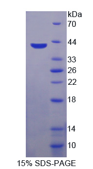 糖磺基转移酶9(CHST9)重组蛋白,Recombinant Carbohydrate Sulfotransferase 9 (CHST9)