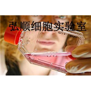 NALM-6 Cells|人急性B淋巴白血病悬浮细胞,NALM-6 Cells