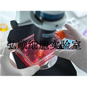 EHEB Cells|人慢性B细胞白血病传代细胞