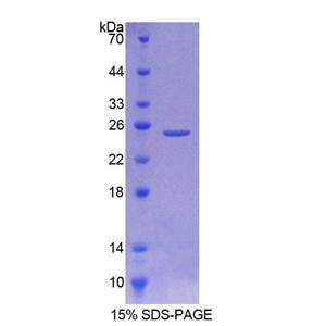 唾液酸酶2(SIAL2)重组蛋白