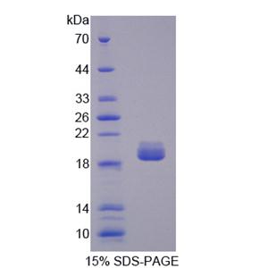 拓扑异构酶Ⅲ(TOP3)重组蛋白