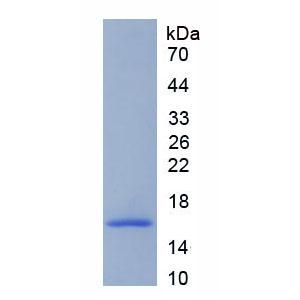 脱支酶同源物1(DBR1)重组蛋白,Recombinant Debranching Enzyme Homolog 1 (DBR1)