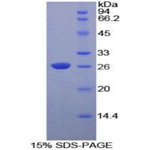 脱氧核糖核酸酶Ⅰ样2(DNASE1L2)重组蛋白
