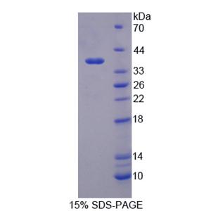 突觸蛋白Ⅰ(SYN1)重組蛋白,Recombinant Synapsin I (SYN1)