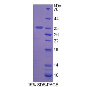 透明带糖蛋白2(ZP2)重组蛋白,Recombinant Zona Pellucida Glycoprotein 2, Sperm Receptor (ZP2)