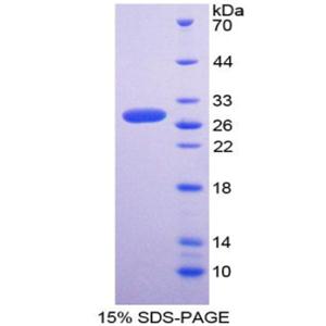 铜伴侣超氧化物歧化酶(SOD4)重组蛋白