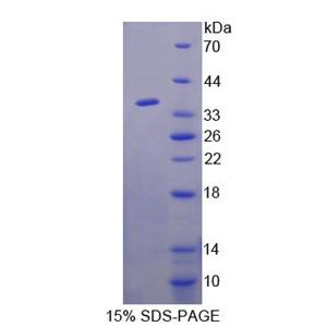 同源域相互作用蛋白激酶1(HIPK1)重组蛋白,Recombinant Homeodomain Interacting Protein Kinase 1 (HIPK1)