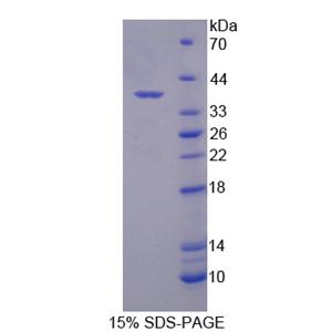 同线蛋白2(ST2)重组蛋白