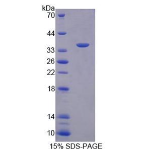 同线蛋白1(ST1)重组蛋白