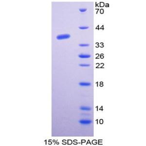 通用转录因子ⅡE肽1(GTF2E1)重组蛋白,Recombinant General Transcription Factor IIE, Polypeptide 1 (GTF2E1)