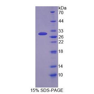 停靠蛋白3(DOK3)重组蛋白