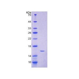 铁调素(Hepc)重组蛋白,Recombinant Hepcidin (Hepc)