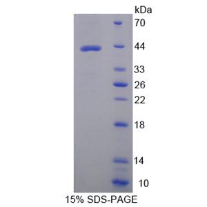 天冬氨酸转氨酶2(AST2)重组蛋白,Recombinant Aspartate Aminotransferase 2 (AST2)