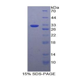 糖原磷酸化酶B(PYGB)重组蛋白,Recombinant Glycogen Phosphorylase, Brain (PYGB)