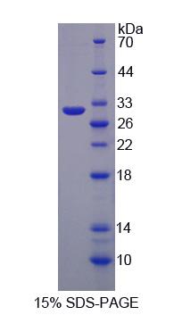 糖蛋白A33(GPA33)重组蛋白,Recombinant Glycoprotein A33 (GPA33)