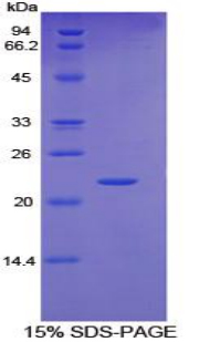 糖蛋白130(gp130)重组蛋白,Recombinant Glycoprotein 130 (gp130)