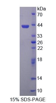 羰基还原酶3(CBR3)重组蛋白,Recombinant Carbonyl Reductase 3 (CBR3)