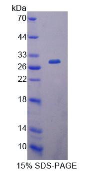 羰基还原酶1(CBR1)重组蛋白,Recombinant Carbonyl Reductase 1 (CBR1)