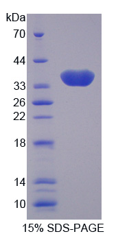 碳酸酐酶Ⅷ(CA8)重組蛋白,Recombinant Carbonic Anhydrase VIII (CA8)