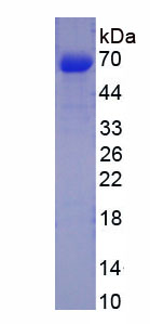 碳酸酐酶Ⅵ(CA6)重組蛋白,Recombinant Carbonic Anhydrase VI (CA6)