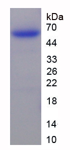 肽酶抑制因子16(PI16)重組蛋白,Recombinant Peptidase Inhibitor 16 (PI16)