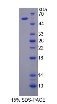 肽酶D(PEPD)重组蛋白,Recombinant Peptidase D (PEPD)