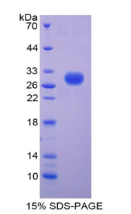 肽聚糖識(shí)別蛋白2(PGLYRP2)重組蛋白,Recombinant Peptidoglycan Recognition Protein 2 (PGLYRP2)