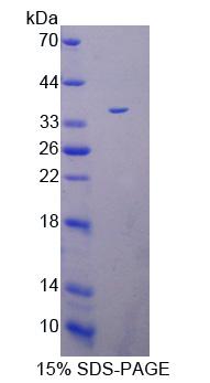 肽基精氨酸脱亚氨酶Ⅳ(PADI4)重组蛋白,Recombinant Peptidyl Arginine Deiminase Type IV (PADI4)