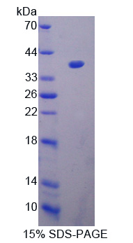 肽基精氨酸脱亚氨酶Ⅲ(PADI3)重组蛋白,Recombinant Peptidyl Arginine Deiminase Type III (PADI3)