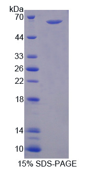 肽基精氨酸脱亚氨酶Ⅱ(PADI2)重组蛋白,Recombinant Peptidyl Arginine Deiminase Type II (PADI2)