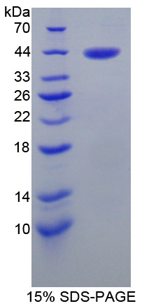 胎盘凝血酶抑制因子(PTI)重组蛋白,Recombinant Placental Thrombin Inhibitor (PTI)