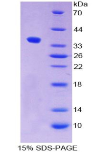 胎盤(pán)堿性磷酸酶樣蛋白2(ALPPL2)重組蛋白,Recombinant Alkaline Phosphatase, Placental Like Protein 2 (ALPPL2)