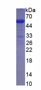 胎盘碱性磷酸酶(ALPP)重组蛋白,Recombinant Alkaline Phosphatase, Placental (ALPP)