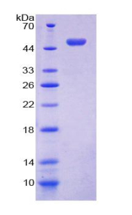 胎盤蛋白13(PP13)重組蛋白,Recombinant Placental Protein 13 (PP13)