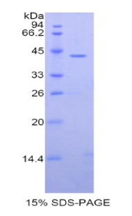 羧肽酶O(CPO)重組蛋白,Recombinant Carboxypeptidase O (CPO)