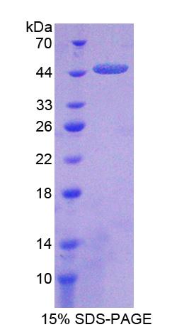 羧肽酶A2(CPA2)重组蛋白,Recombinant Carboxypeptidase A2, Pancreatic (CPA2)